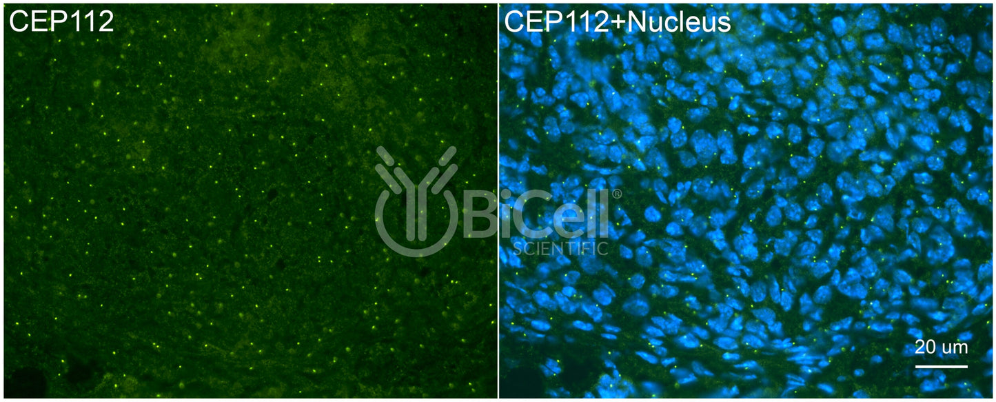 CEP112 (CCDC46) Antibody - FFPE Validated