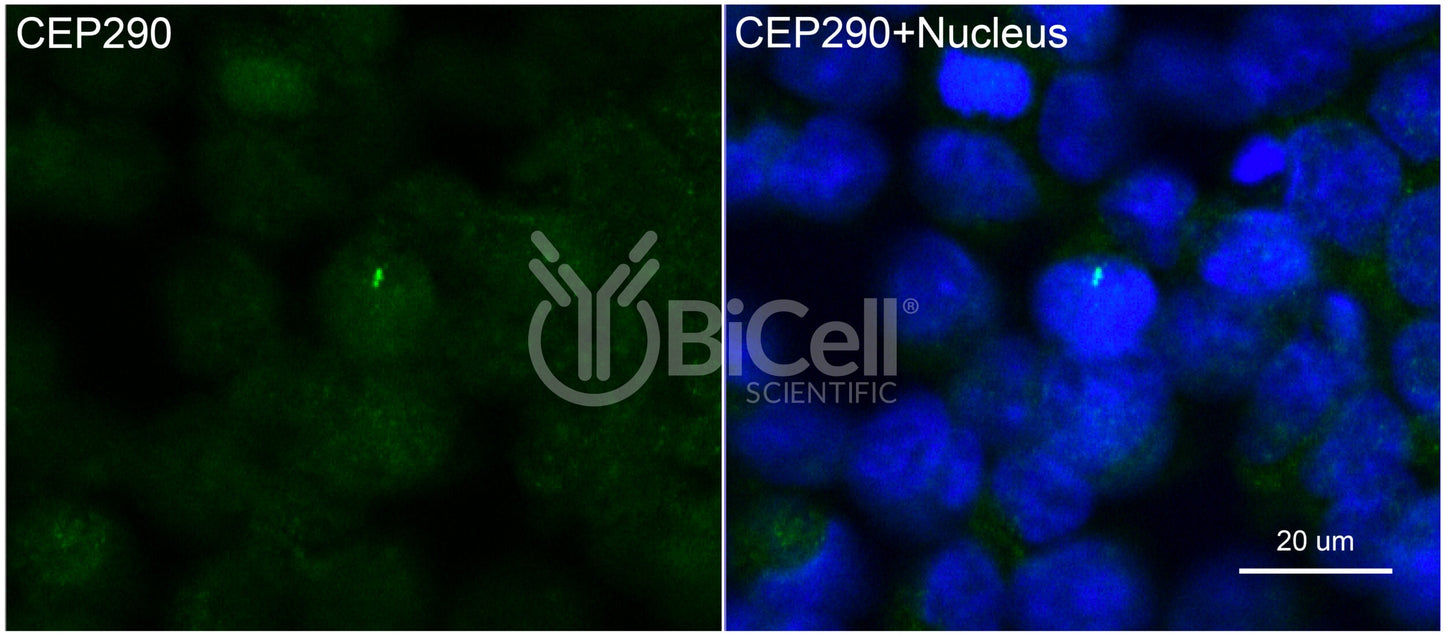 Nephrocystin-6 (Human) (NPHP6 or CEP290 or MKS4 or BBS14) Antibody - Western Blot Validated