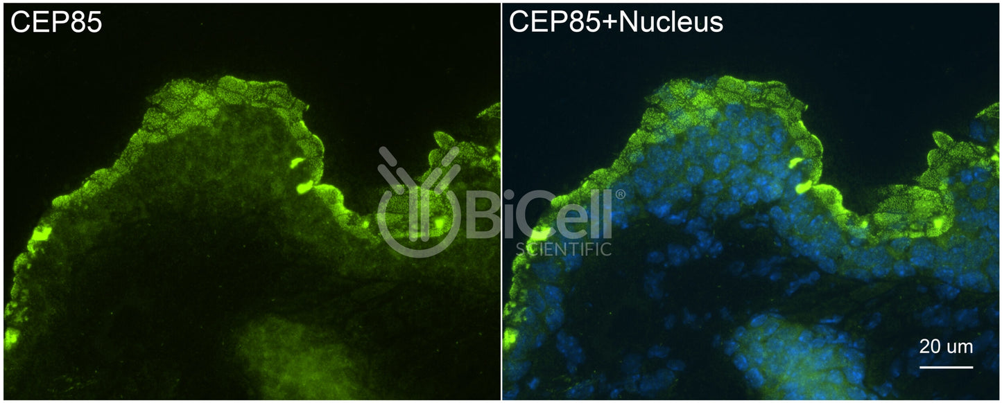 CEP85 (CCDC21) Antibody - Western Blot Validated