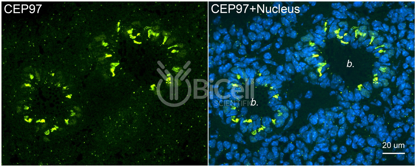 CEP97 Antibody - FFPE Validated