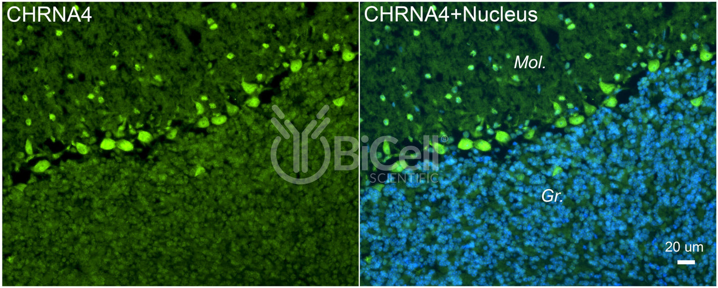 CHRNA4 (NACHRA4) Antibody - Western Blot Validated