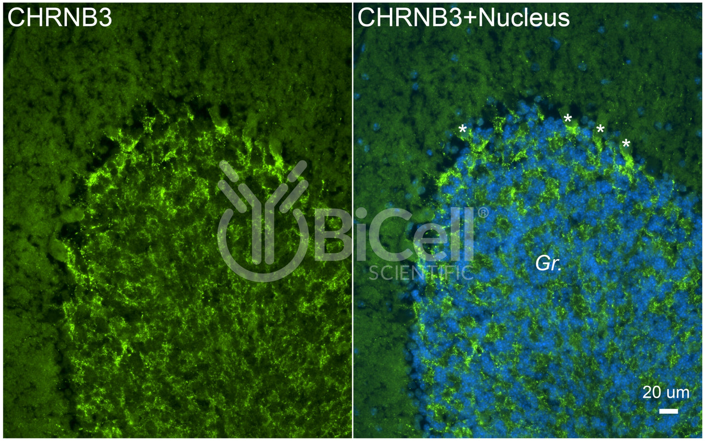 CHRNB3 Antibody - FFPE Validated