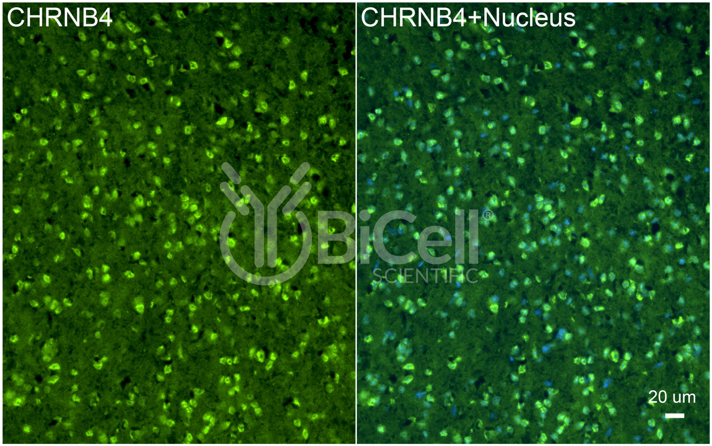 CHRNB4 Antibody - Western Blot Validated