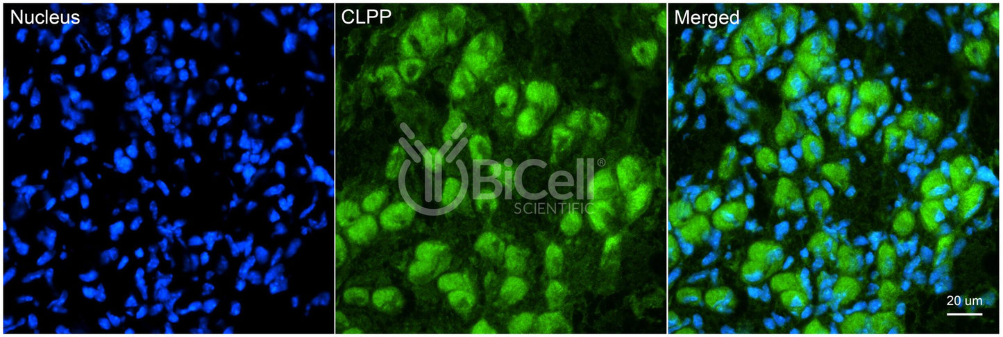 CLPP (PRLTS3 or DFNB81) Antibody - Western Blot Validated