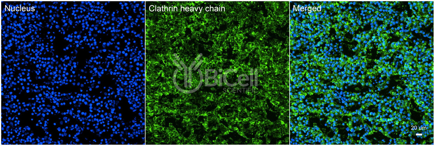 Clathrin Heavy Chain (CLTC) HiRe Antibody