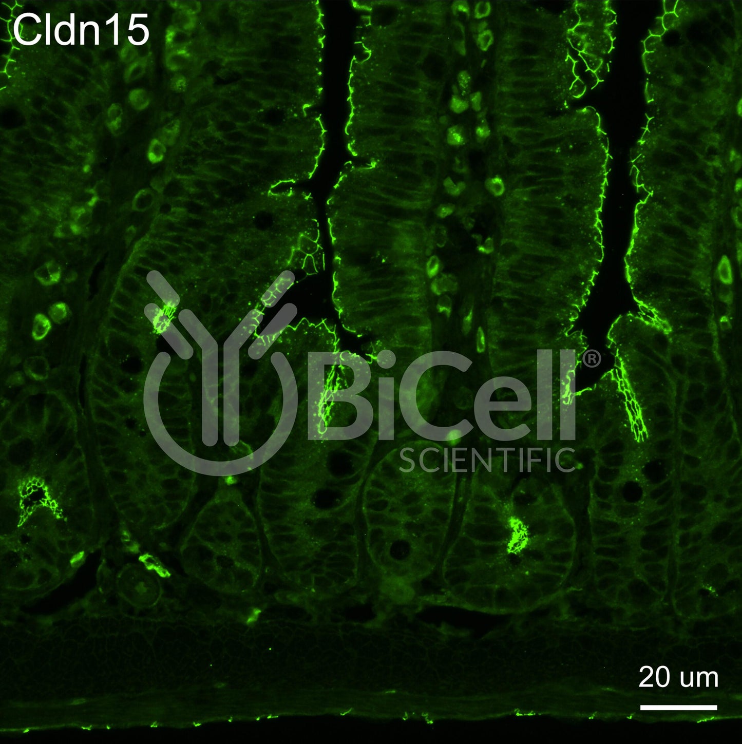 Claudin-15 (CLDN15) Monoclonal Antibody (A10 Clone) - FFPE Validated