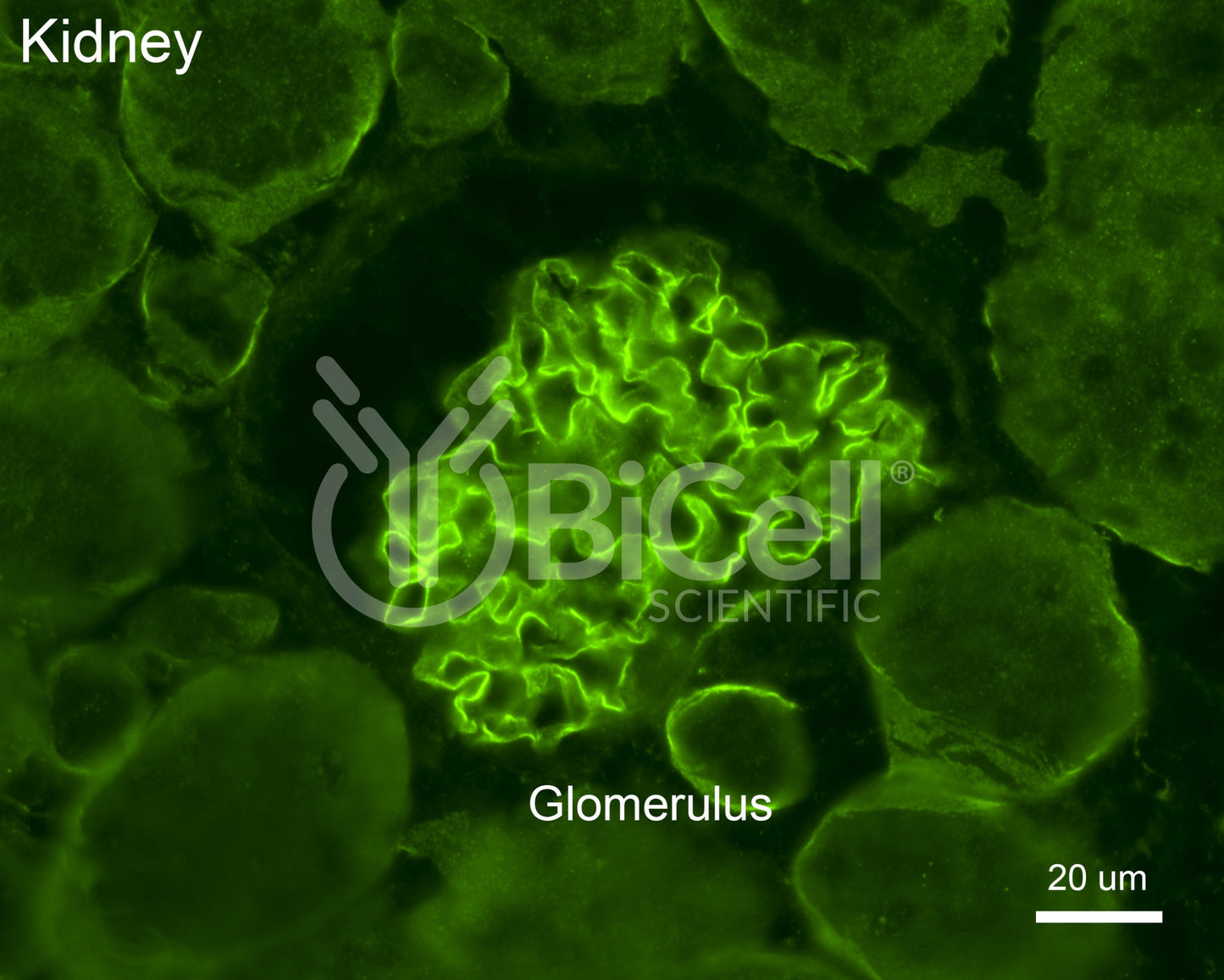 Collagen alpha-3 (IV) (Col4a3) Antibody - FFPE Validated
