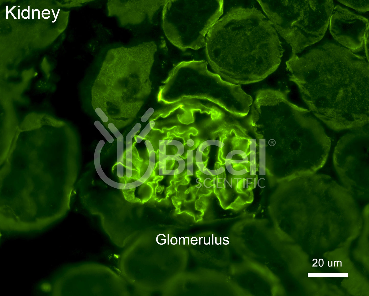 Collagen alpha-5 (IV) (Col4a5) Antibody - Western Blot Validated