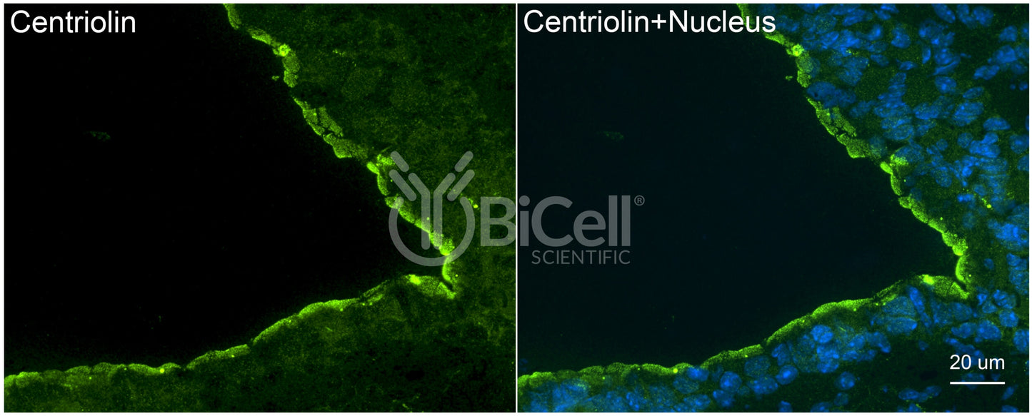 Centriolin (CEP110) Antibody - Western Blot Validated