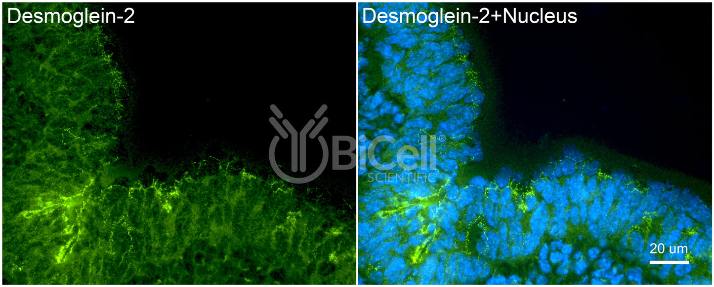 Desmoglein-2 (DSG2) Antibody - FFPE Validated