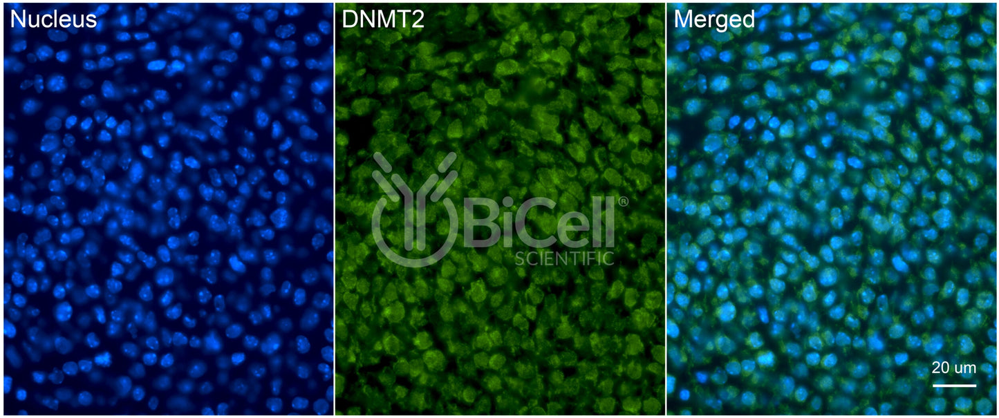 DNMT2 (TRDMT1) Antibody - FFPE Validated