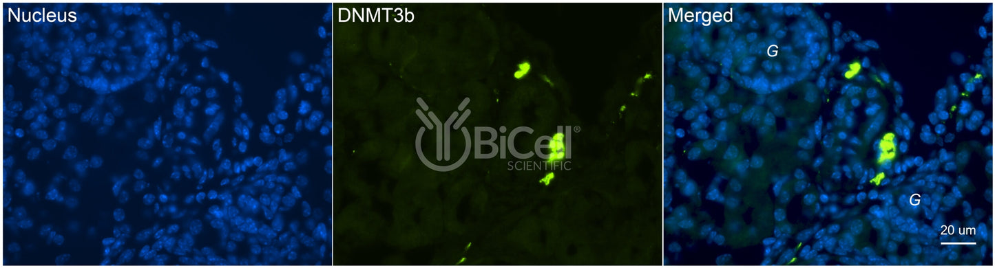 DNMT3B Antibody