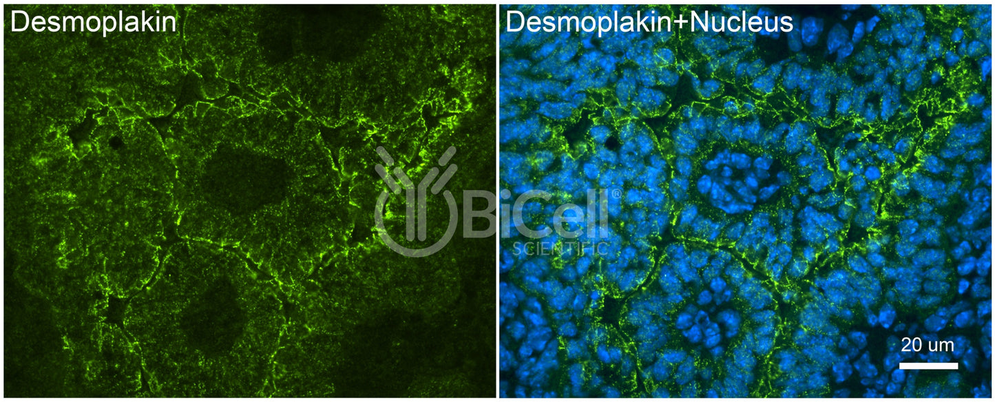 Desmoplakin (DSP) Antibody - Western Blot Validated