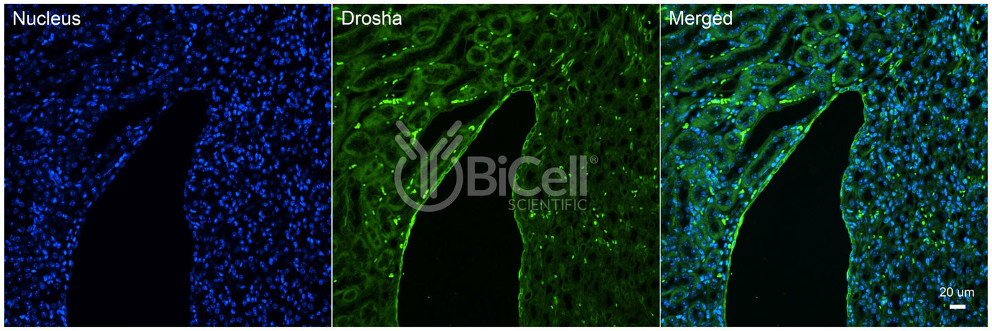 DROSHA (RNASEN) Antibody - FFPE Validated