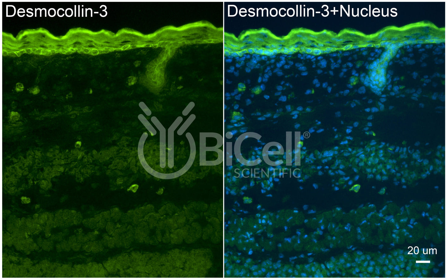 Desmocollin-3 (DSC3) Antibody - FFPE Validated