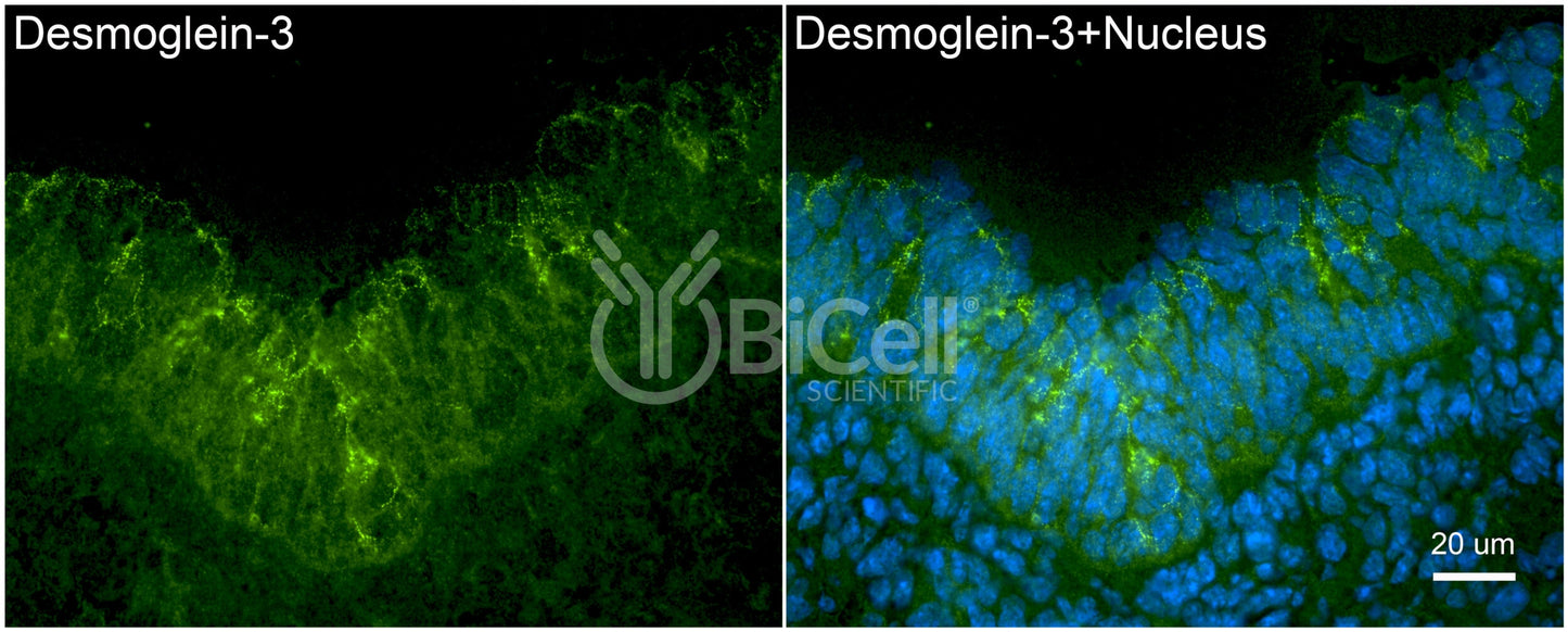 Desmoglein-3 (DSG3) Antibody - FFPE Validated