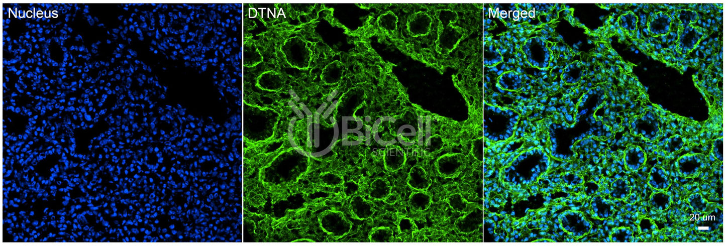 Dystrobrevin alpha (DTNA) Antibody - Western Blot Validated