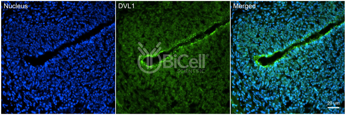 DVL1 (DVL) Antibody - FFPE Validated