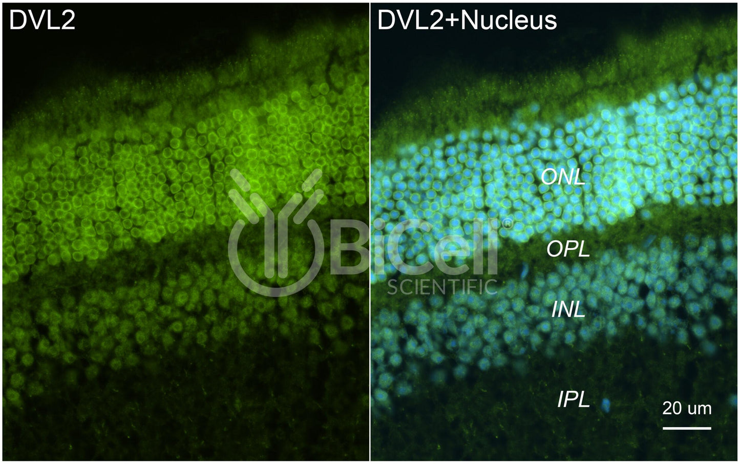 DVL2 Antibody - FFPE Validated