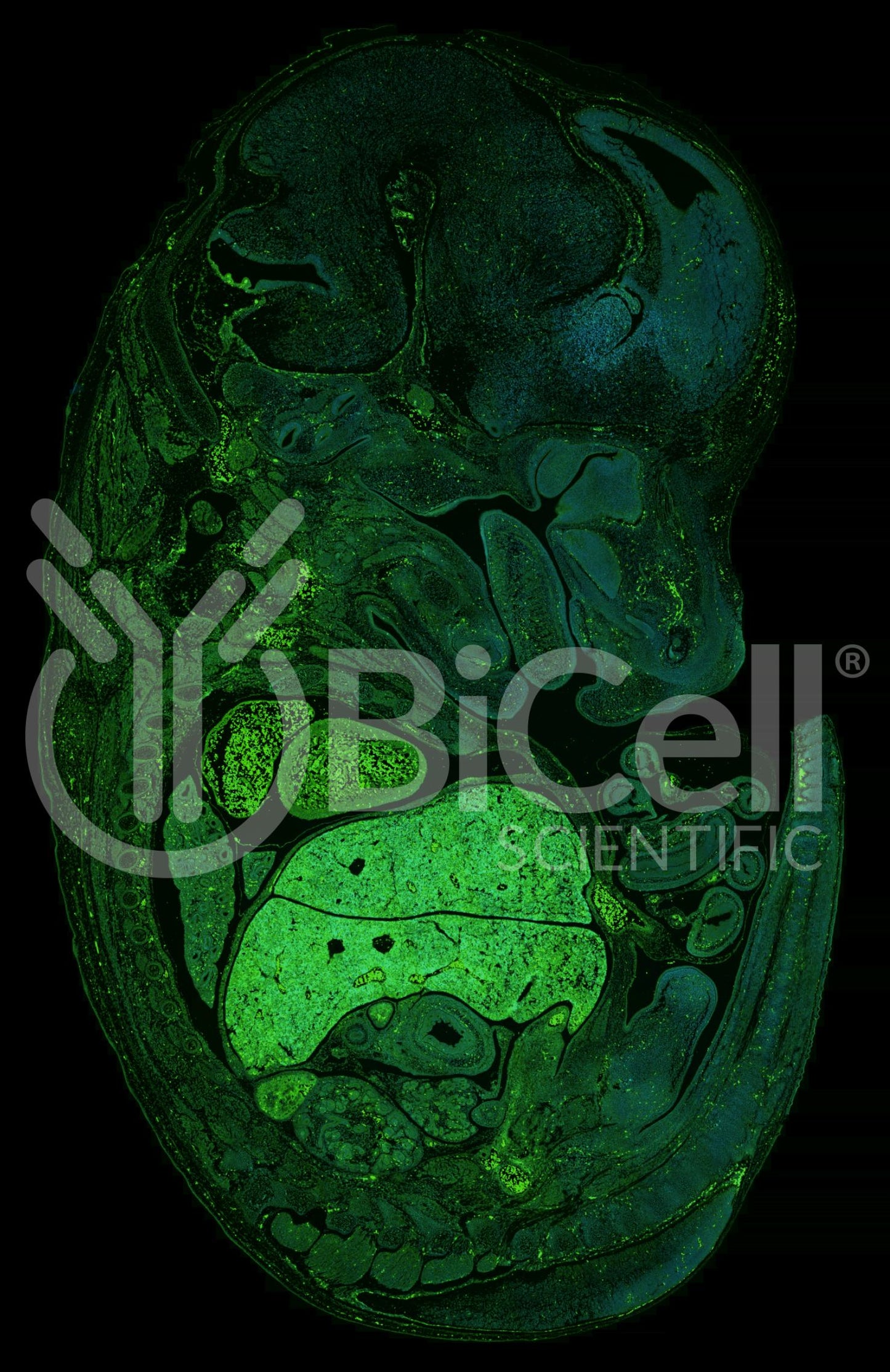 Dystrophin (DMD) Antibody - FFPE Validated