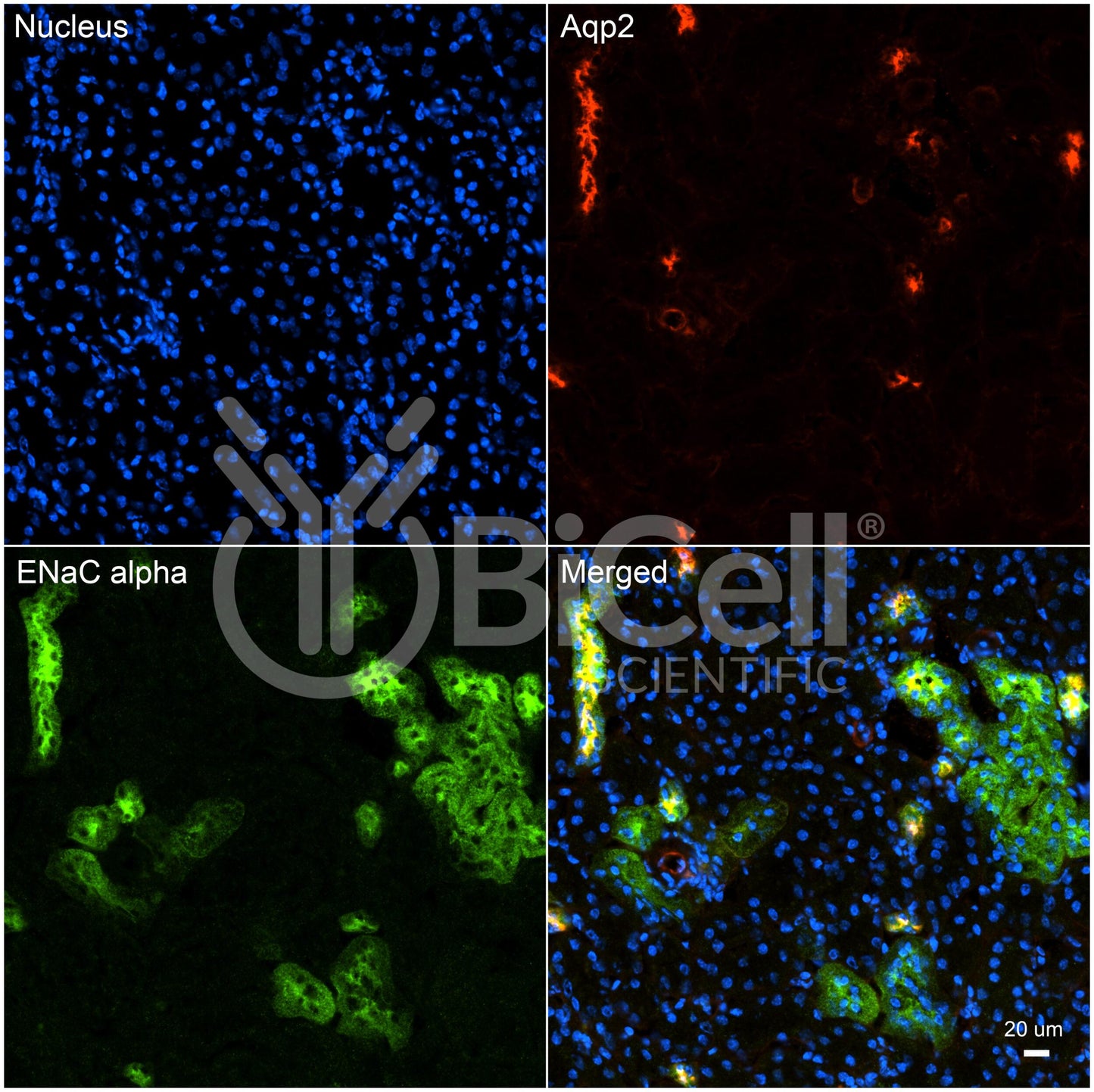 ENaC alpha (Scnn1a) (C-Terminus) Antibody - Western Blot Validated