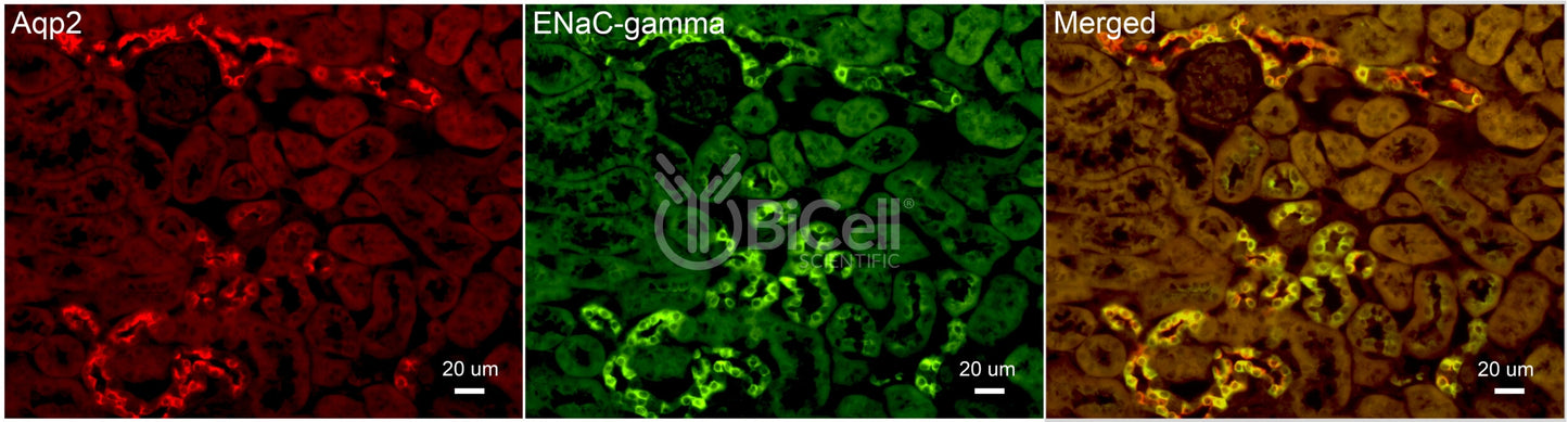 ENaC gamma (Scnn1g) Antibody - FFPE Validated