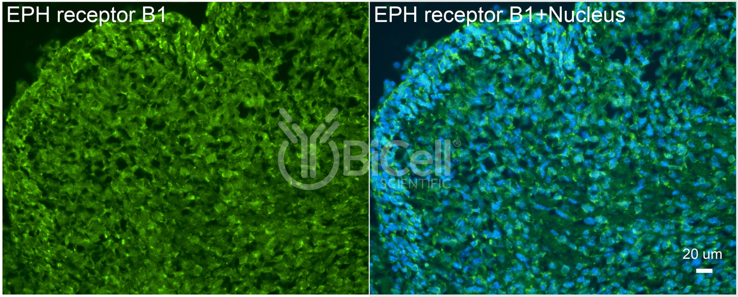 EPH receptor B1 (EPHB1) Antibody - FFPE Validated