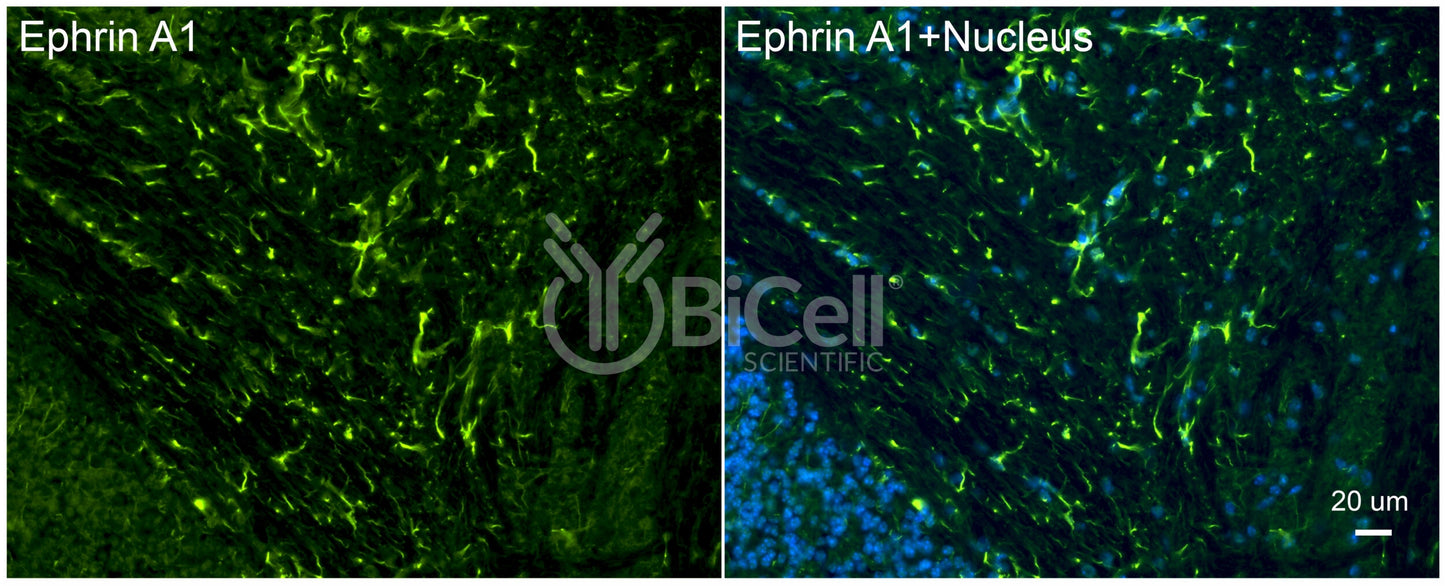 Ephrin A1 (EFNA1) Antibody - FFPE Validated