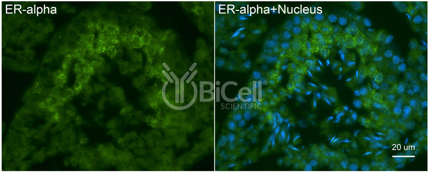 ER alpha (ESR1 or NR3A1) Antibody