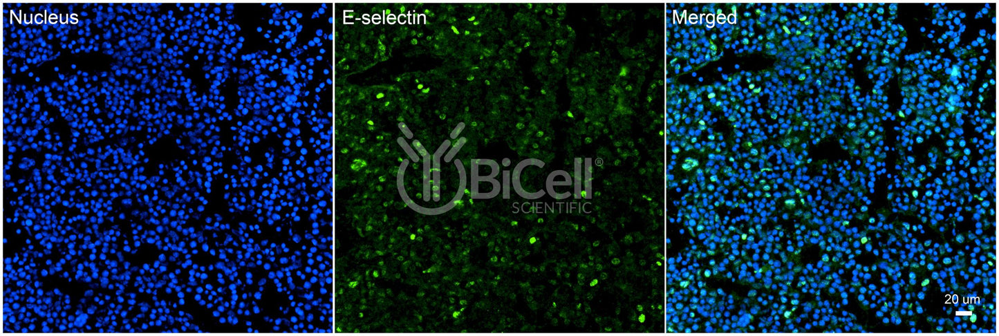 E-selectin (SELE or LECAM2 or CD62E) Antibody