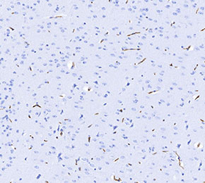 Nestin Antibody