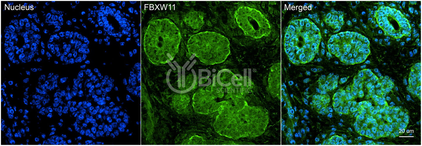 FBXW11 (BTRCP2 or NEDJED) (C-Terminus) Antibody