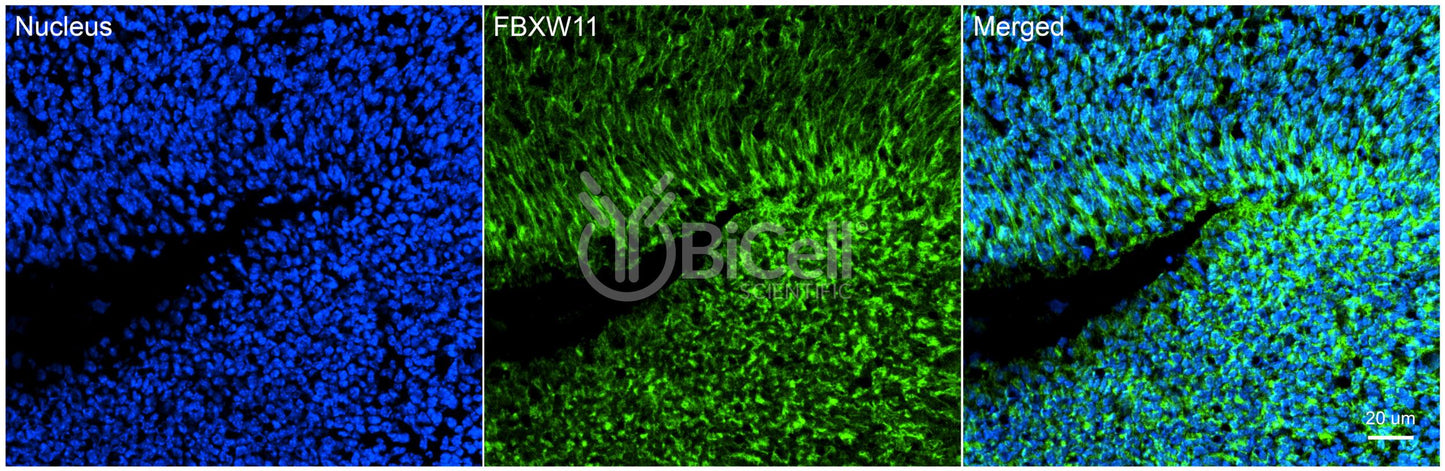 FBXW11 (BTRCP2 or NEDJED) (N-Terminus) Antibody