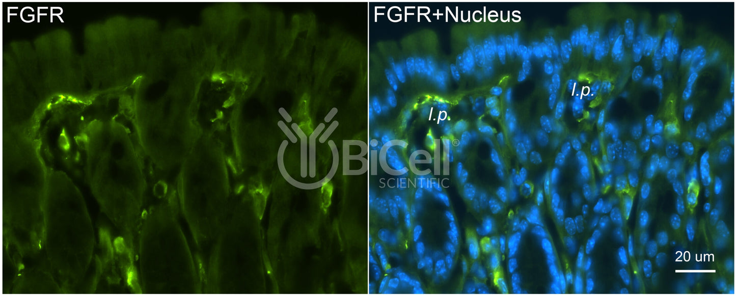 FGFR1 (FLT2 or CD331) Antibody - FFPE Validated