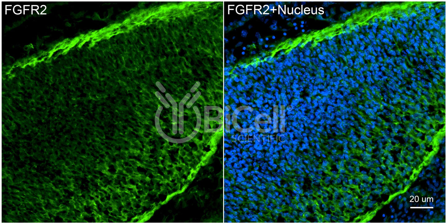FGFR2 (CD332) Antibody
