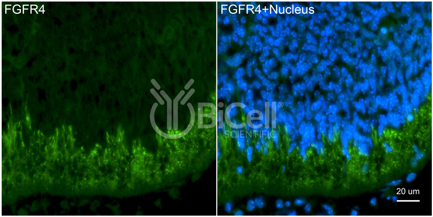 FGFR4 (CD334) Antibody - FFPE Validated