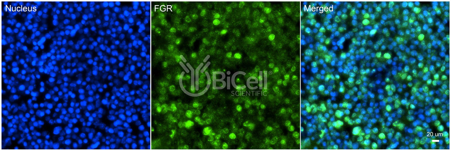 FGR (SRC2) Antibody - Western Blot Validated