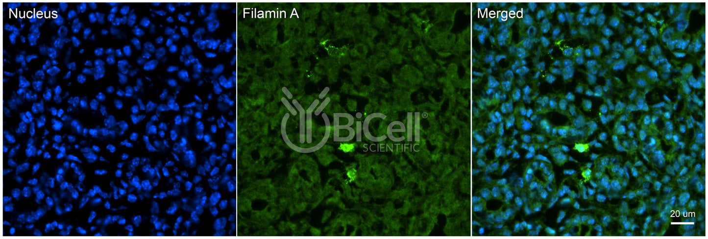 Filamin A (FLNA) Antibody - FFPE Validated