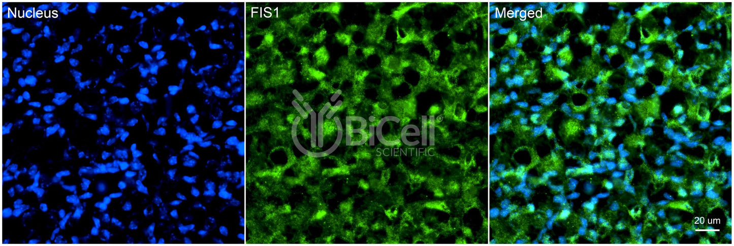 FIS1 (TTC11) Antibody - FFPE Validated