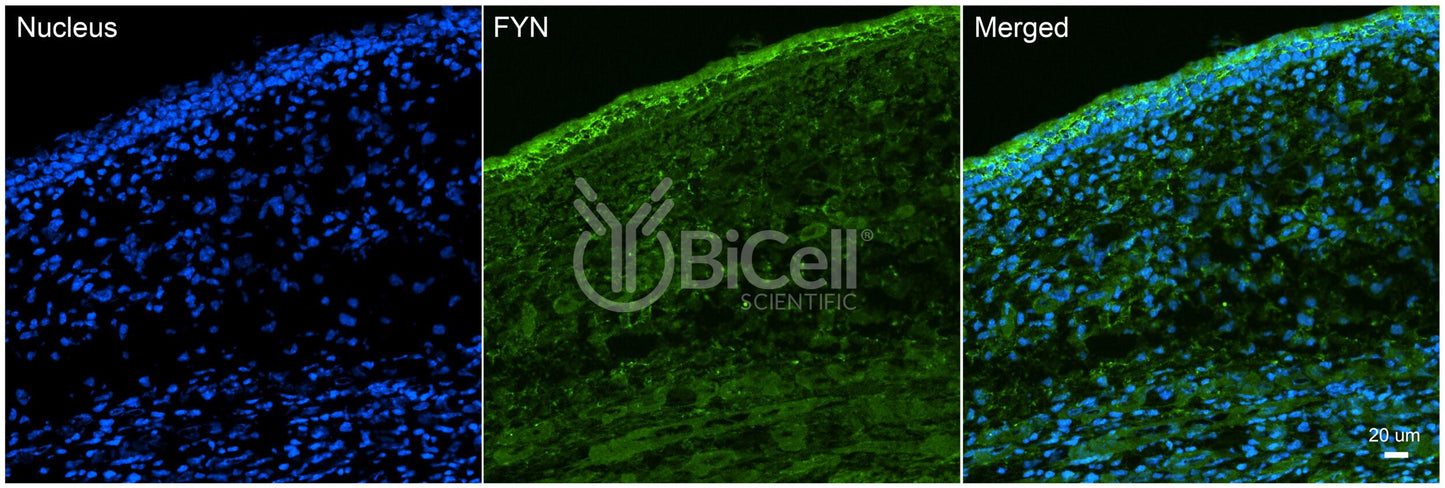 FYN (SLK) Antibody - FFPE Validated