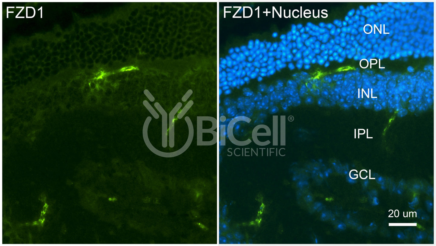 Frizzled-1 (FZD1) Antibody - FFPE Validated