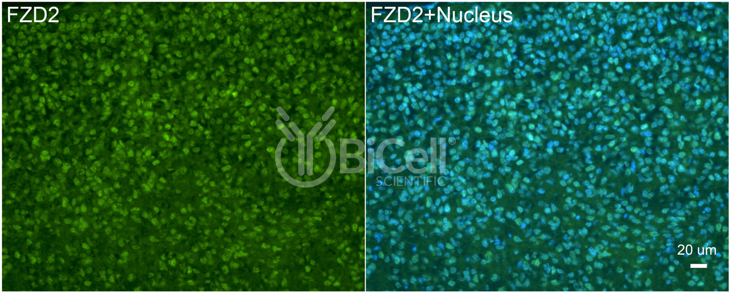 Frizzled-2 (FZD2) Antibody - FFPE Validated