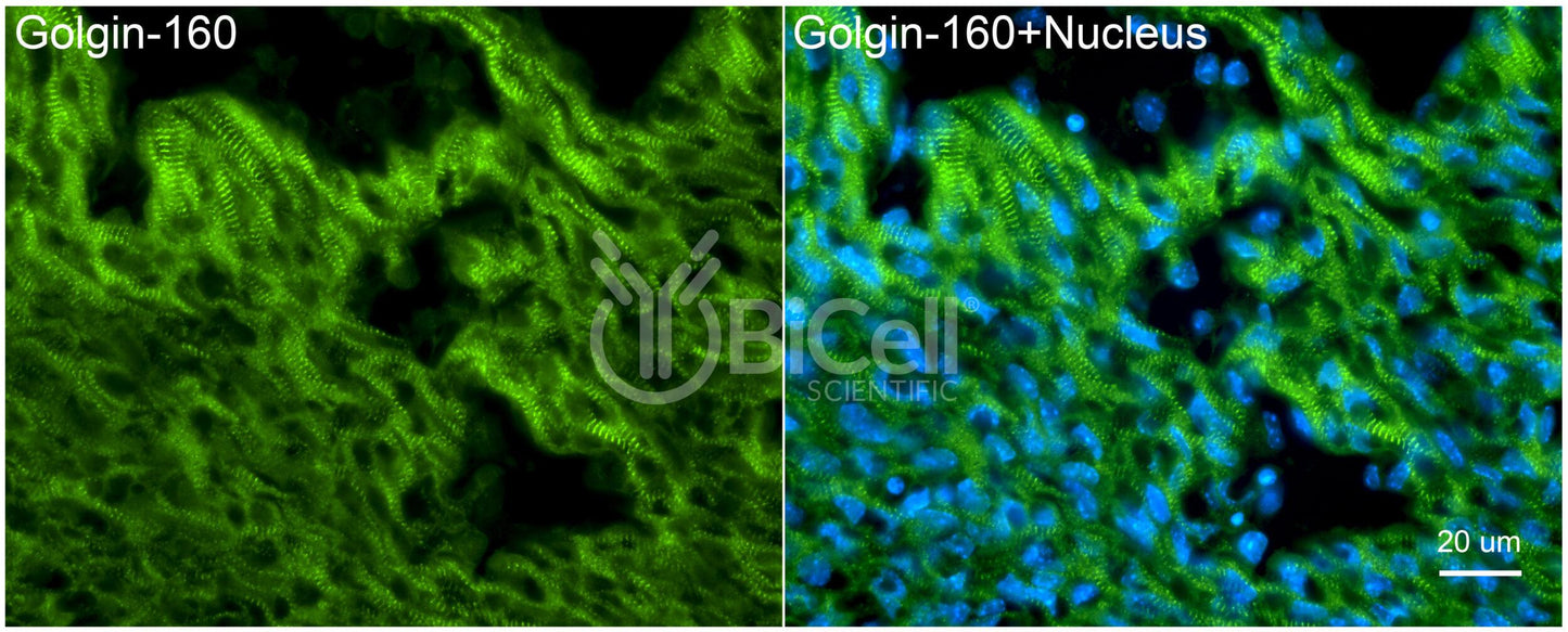 GOLGA3 (Golgin-A3 or Golgin-160) Antibody - FFPE Validated