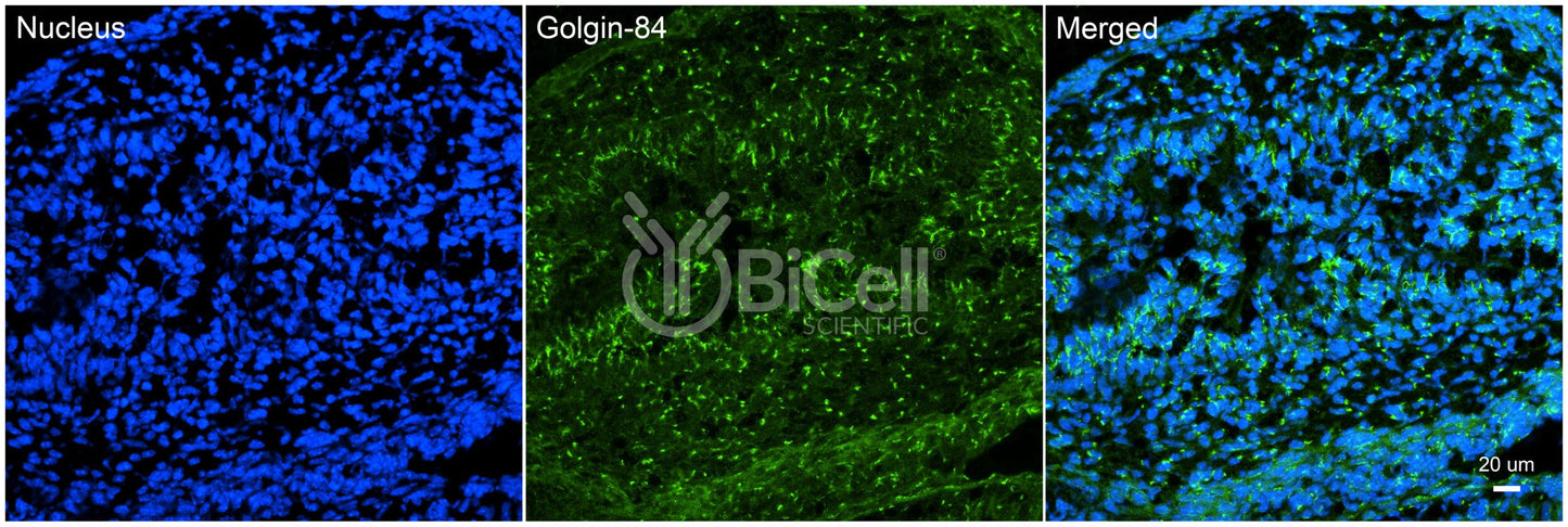 GOLGA5 (Golgin-A5 or Golgin-84) Antibody - FFPE Validated