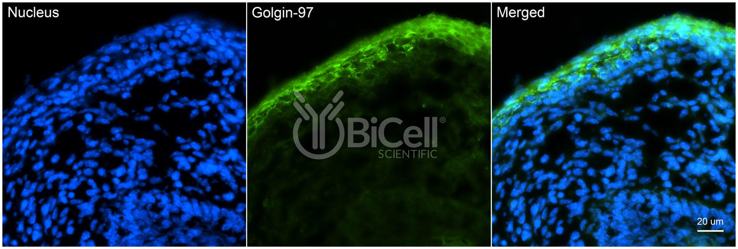 GOLGA1 (Golgin-97) Antibody - FFPE Validated
