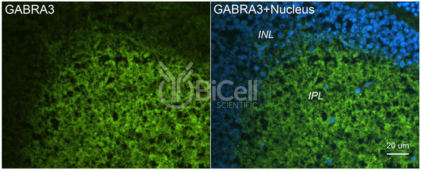 GABRA3 Antibody - FFPE Validated