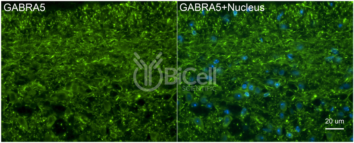 GABRA5 Antibody - FFPE Validated