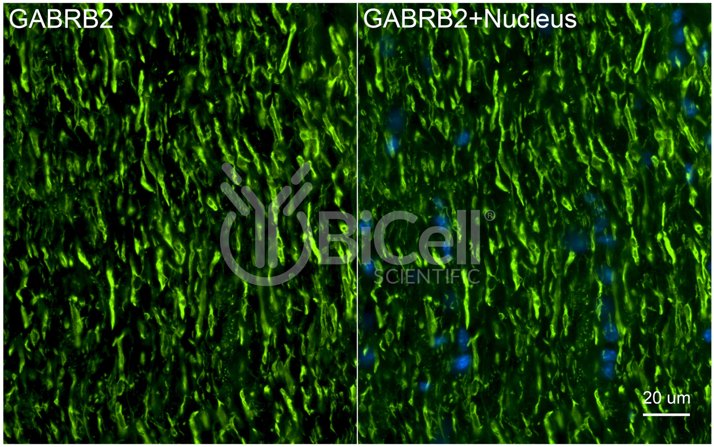 GABRB2 Antibody - Western Blot Validated