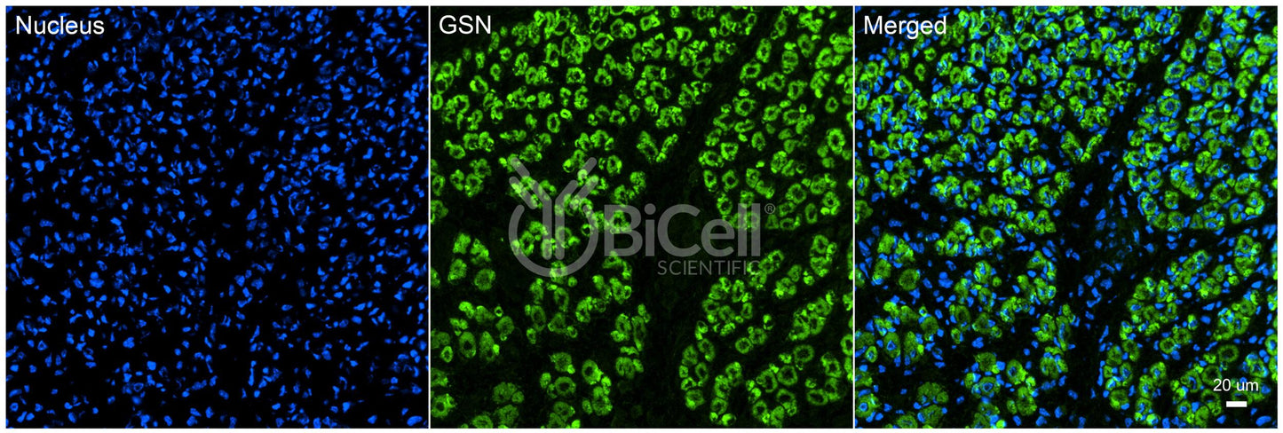 Gelsolin (GSN) Antibody