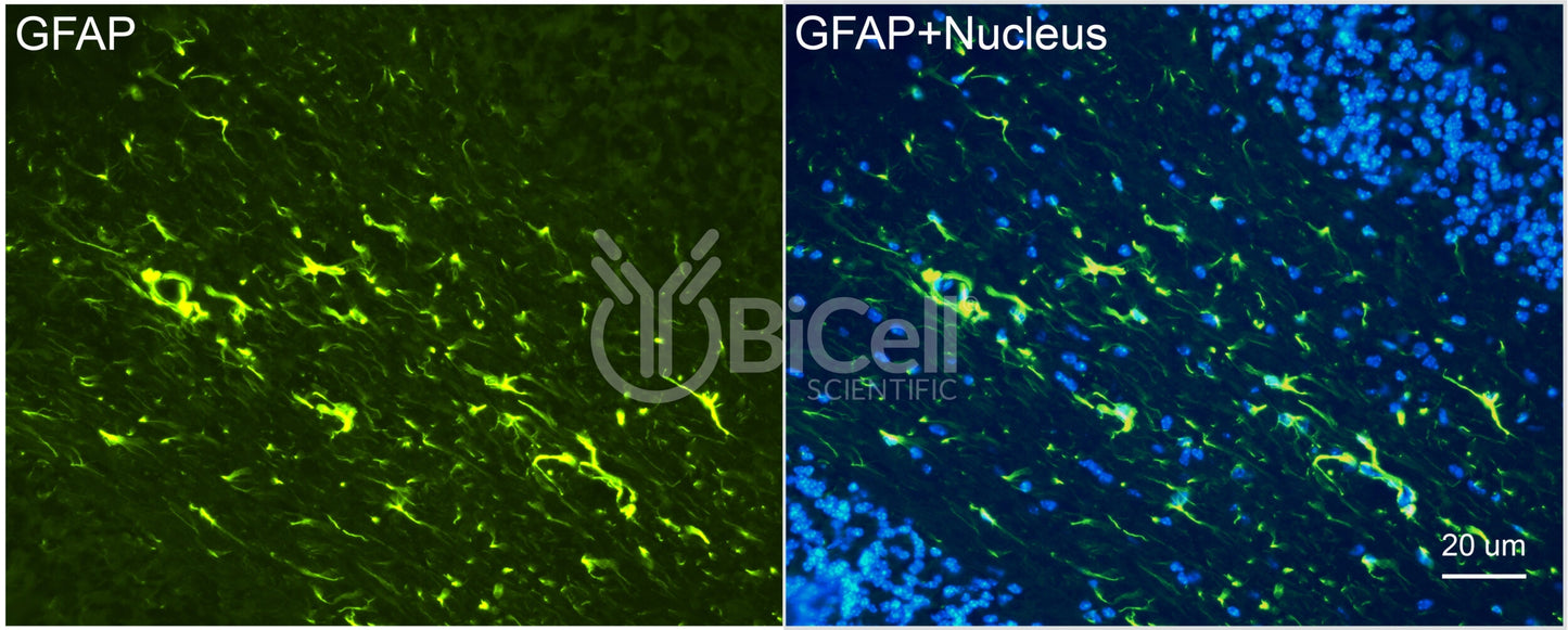 GFAP Antibody